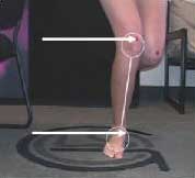 Biomechanical assessment