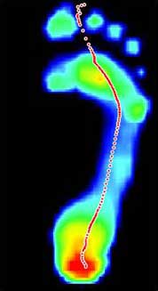 Dynamic force scan of foot