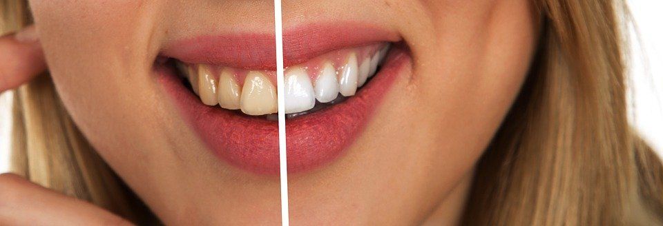 Central Coast Dentist | Dentistry | Oral Hygiene | Central Coast