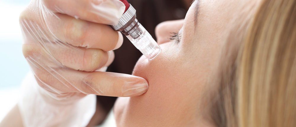 Eine Frau bekommt eine Botox-Injektion ins Gesicht.