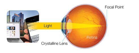 Healthy Eye