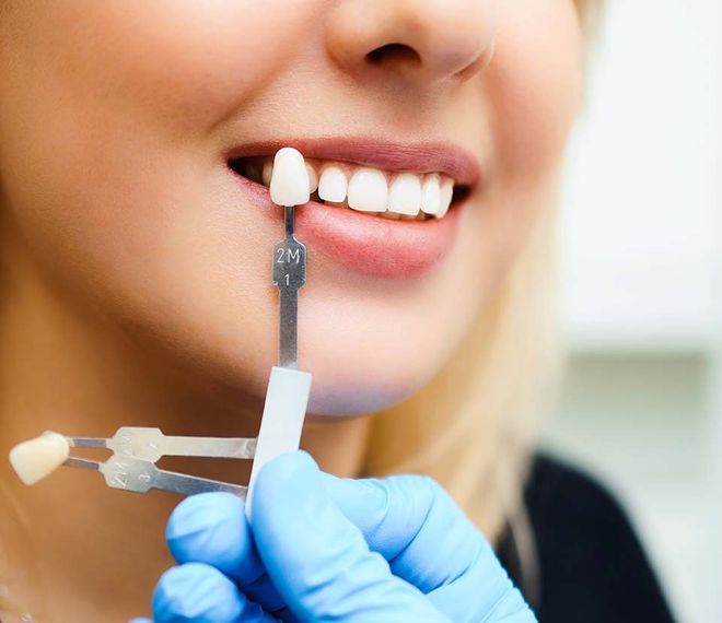 capsule dentali