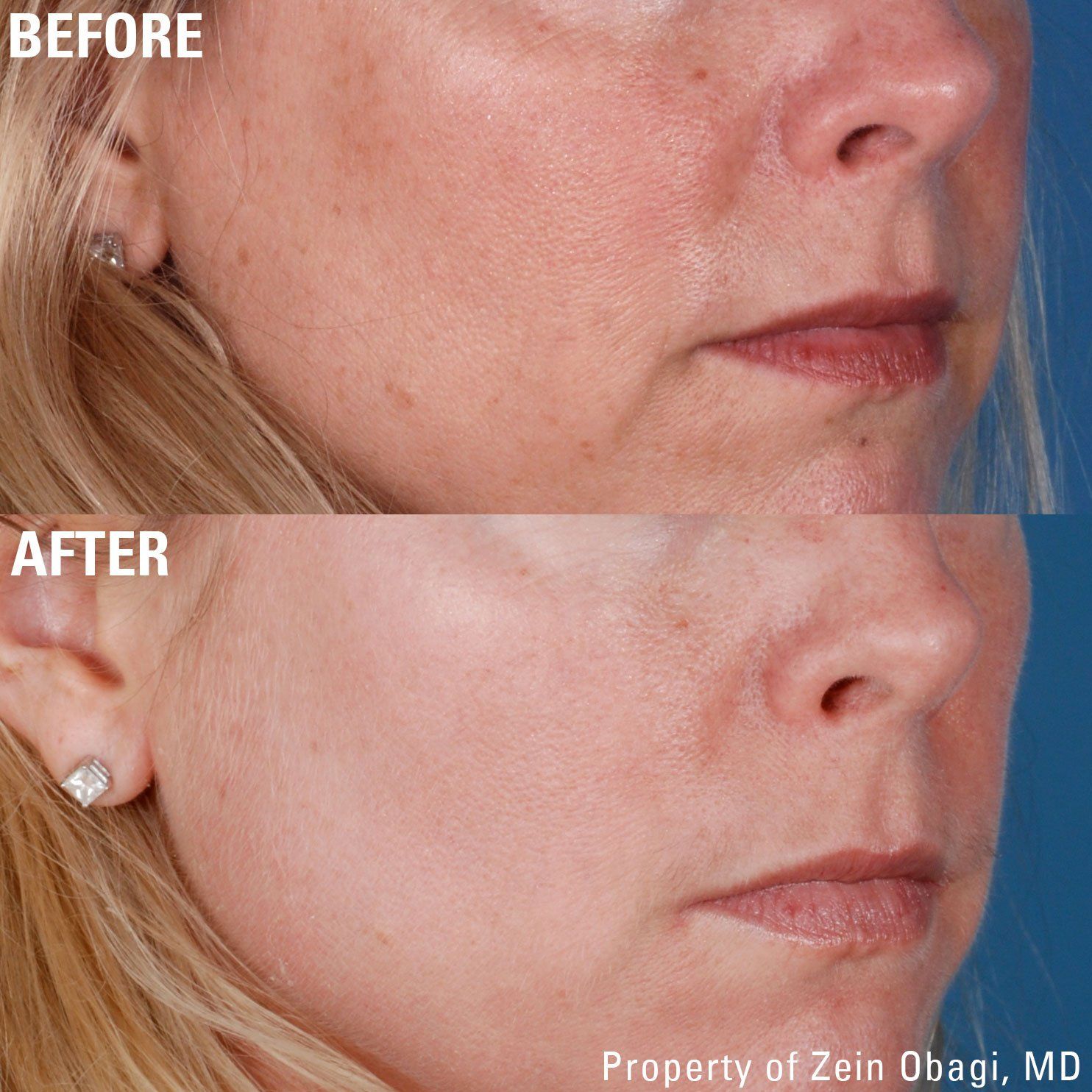 A before and after photo of a woman 's face