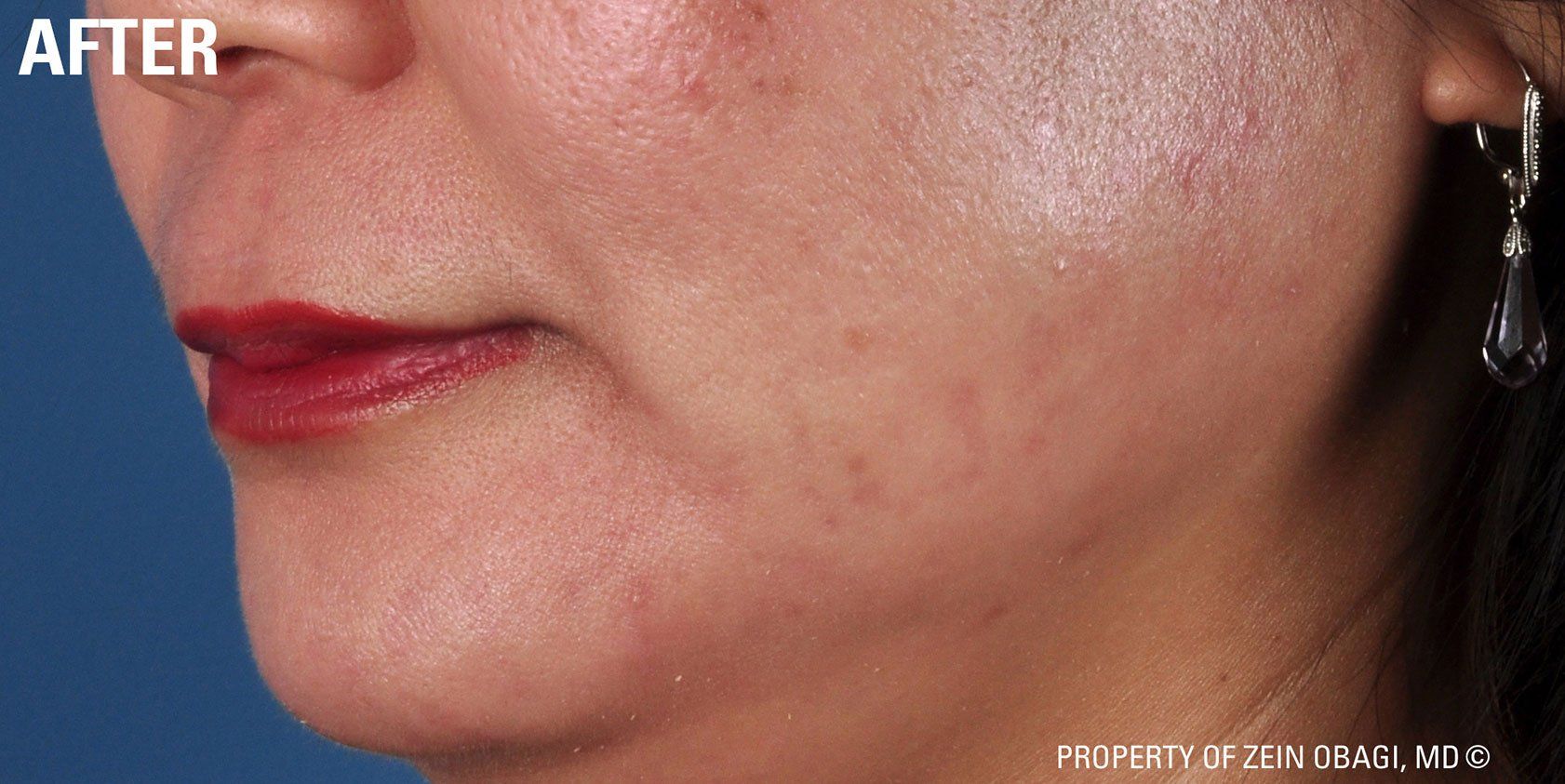 A close up of a woman 's face with red lips and earrings.