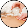 Cupping therapy