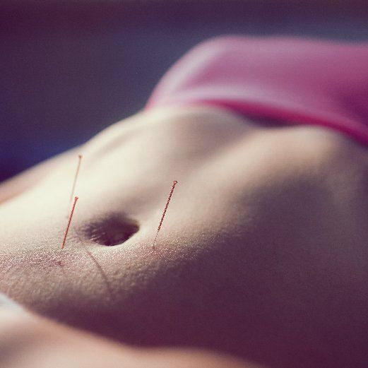 Acupuncture for Fertility