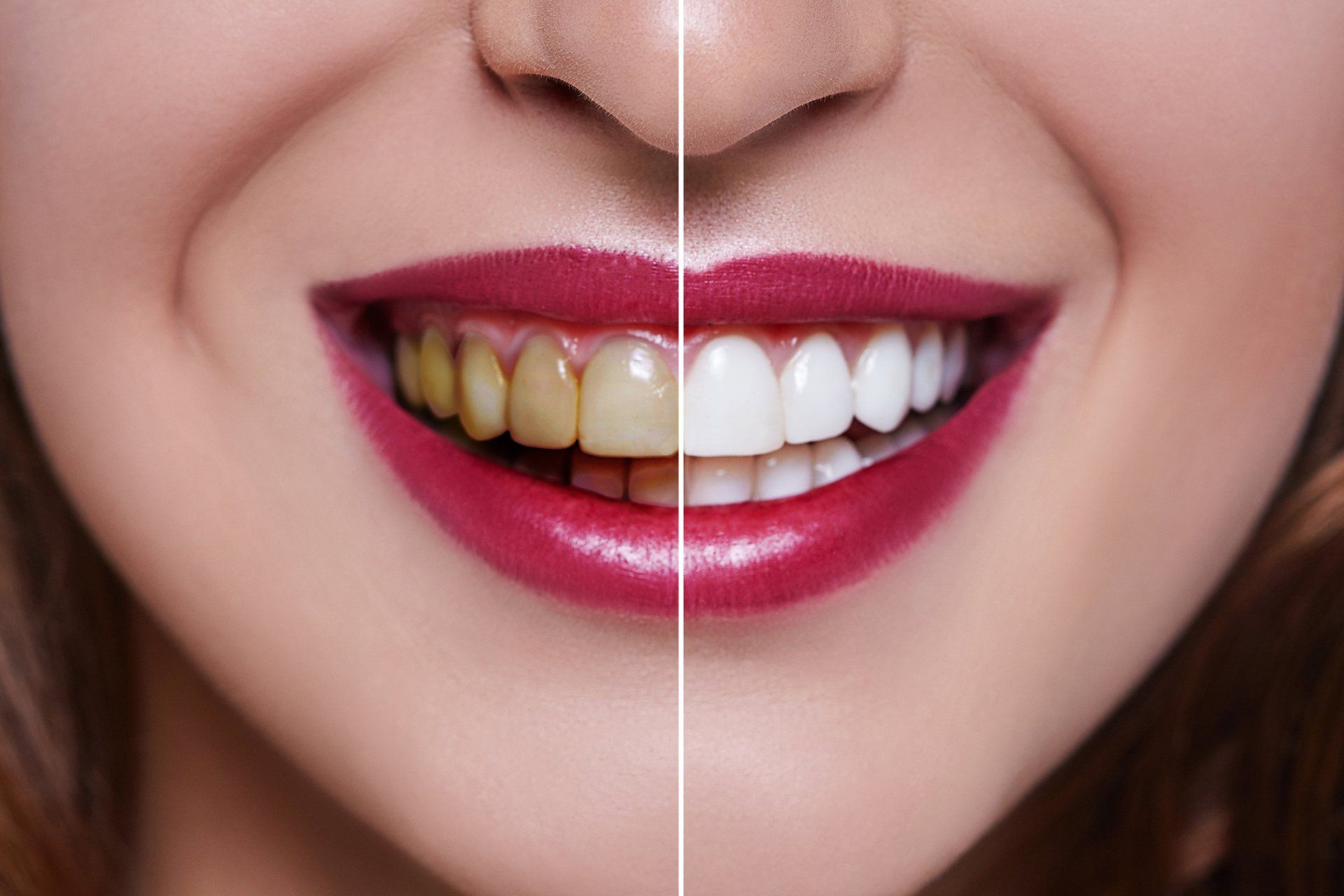 Dental Restorations — Taylor, MI — Taylor Smiles Dental Restorations — Taylor, MI — Taylor Smiles