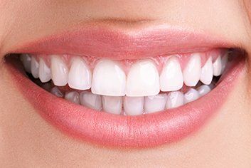teeth whitening