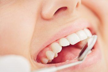 dental clean-up