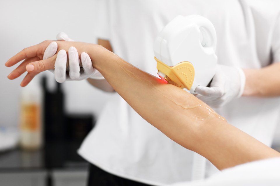 Medicina estetica laser e luce pulsata