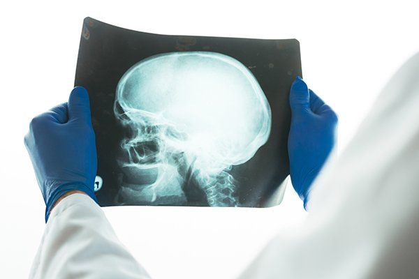 Doctor in a white coat and blue gloves holding up a lateral view X-ray of a human skull against a white background.