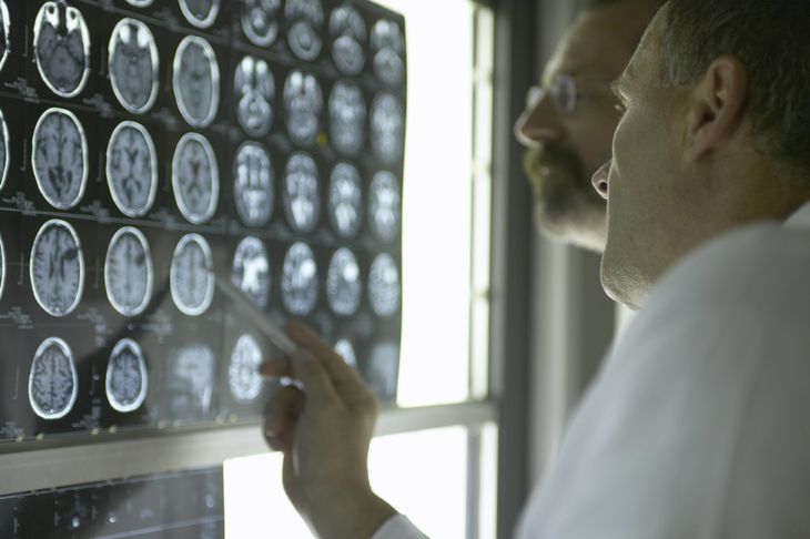 Doctors analyzing brain MRI
