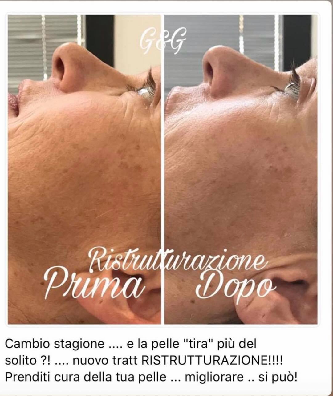 trattamento pelle viso