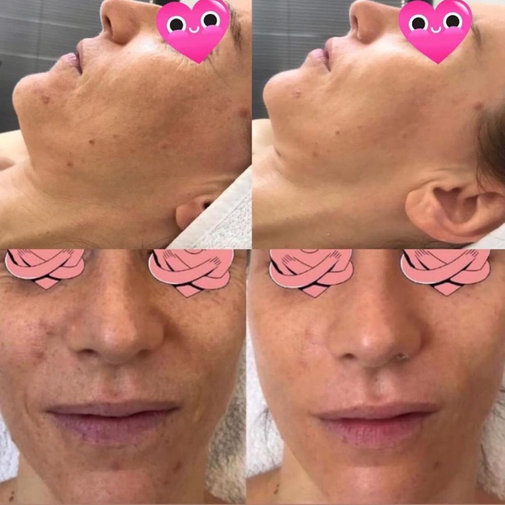 trattamenti viso