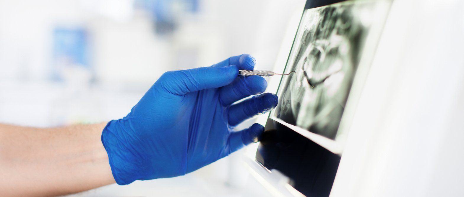 Regular dental check ups looking for root canal