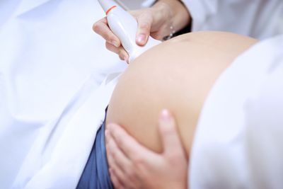 Happy Woman Holding Ultrasound Result — Los Angeles, CA — Ultra Scan Services Happy Woman Holding Ultrasound Result — Los Angeles, CA — Ultra Scan Services