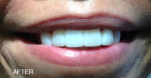 A close up of a woman 's mouth with white teeth and pink lips.