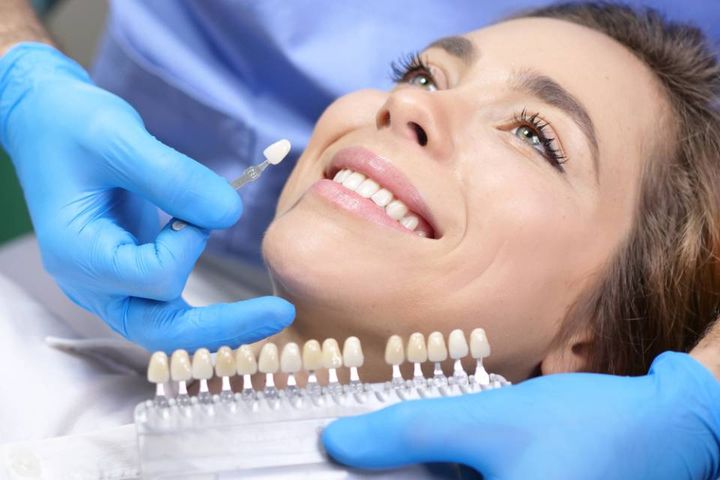 Sbiancamento dentale