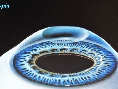 retina