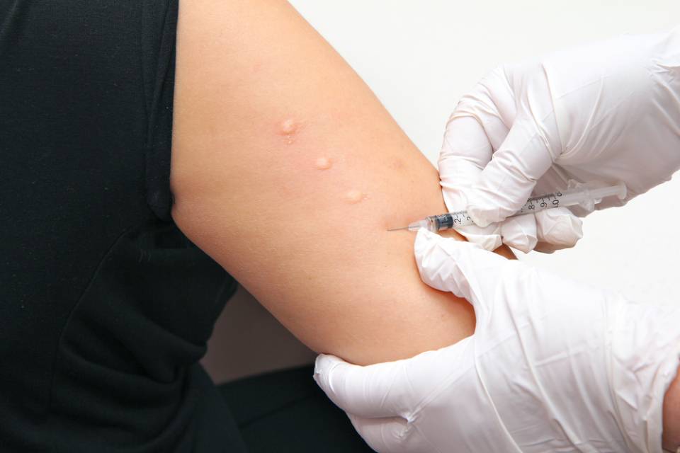 check-up immunologico