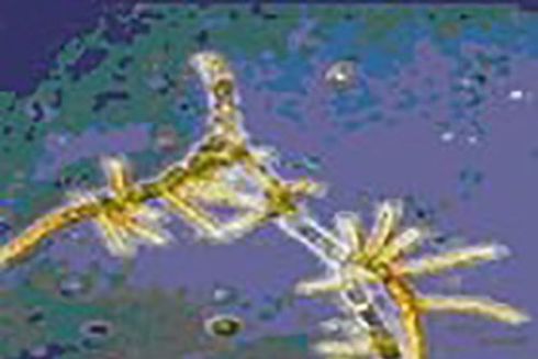 microrganismo al microscopio