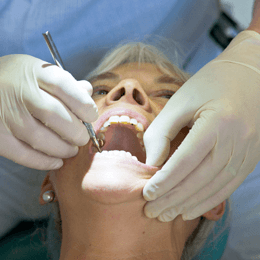crowns treatment