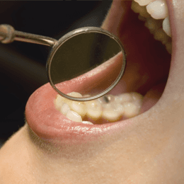 gum disease
