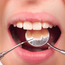 Teeth hygiene