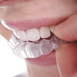Teeth implants