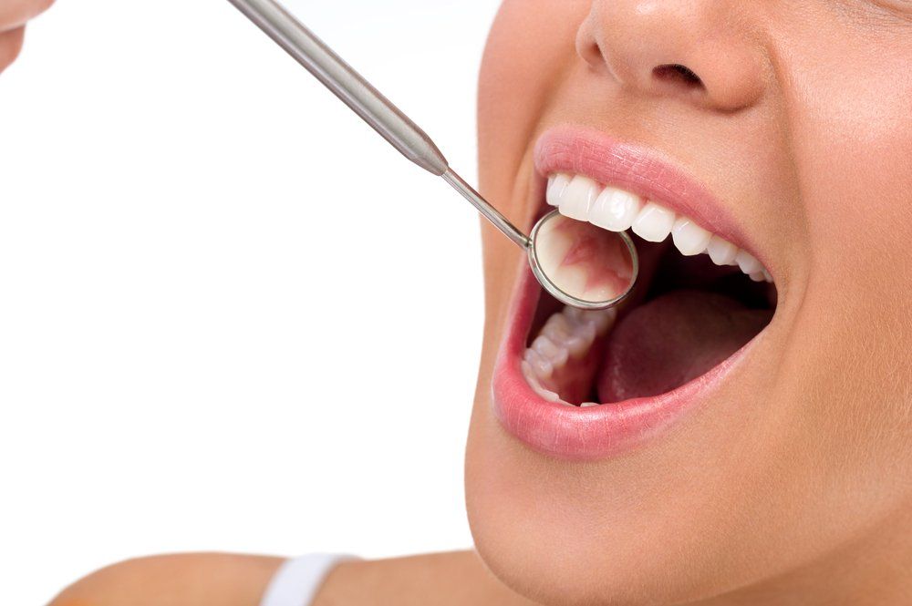 Implant Option