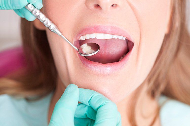 Dentist examining a patient's mouth with a mirror; close-up view of the patient's open mouth.