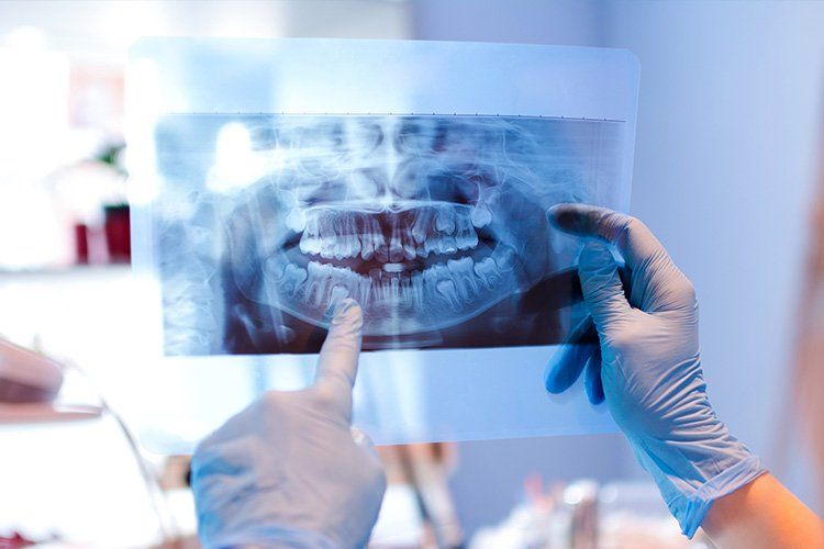 Dentist holding up and pointing at a dental X-ray with gloved hands.