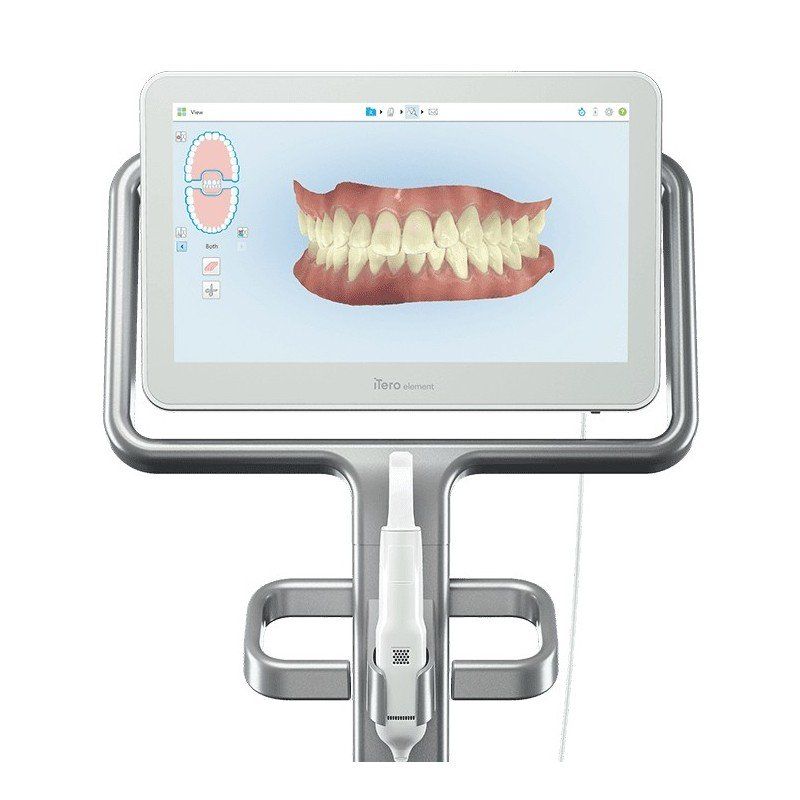 Dental 3D scanner screen showing a 3D scan of teeth. Mounted on a stainless steel stand.