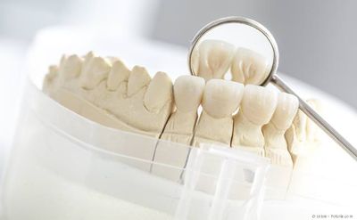Ästhetische Gestaltung von Kronen aus reiner Keramik in unserem praxiseigenen zahntechnischen Fachlabor Ästhetische Gestaltung von Kronen aus reiner Keramik in unserem praxiseigenen zahntechnischen Fachlabor