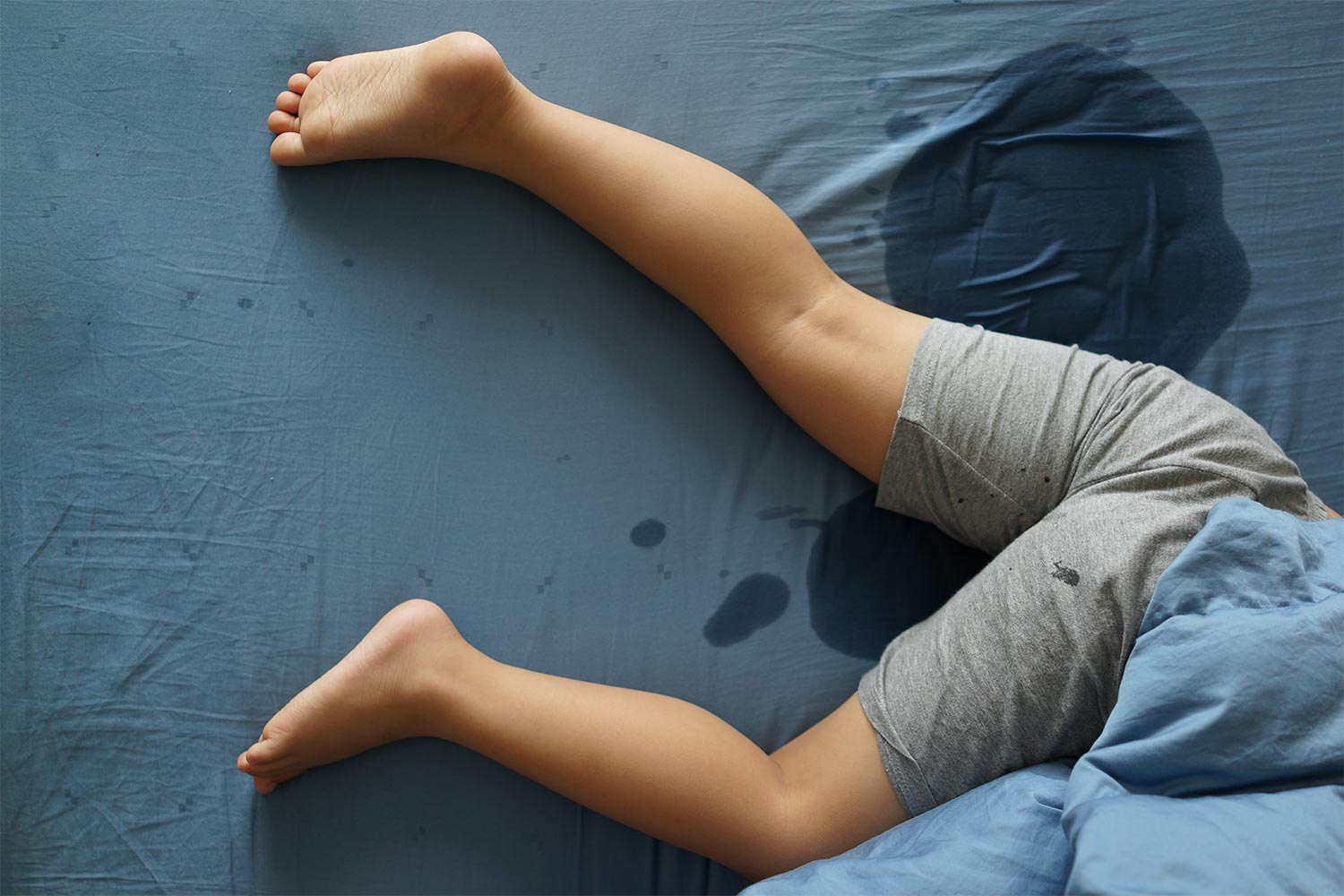 Urine Incontinence