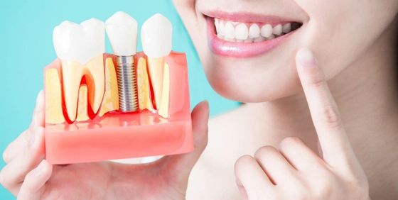 Cosmetic Dentistry — Woman take tooth implant false tooth on green background in Cordova, TN Cosmetic Dentistry — Woman take tooth implant false tooth on green background in Cordova, TN