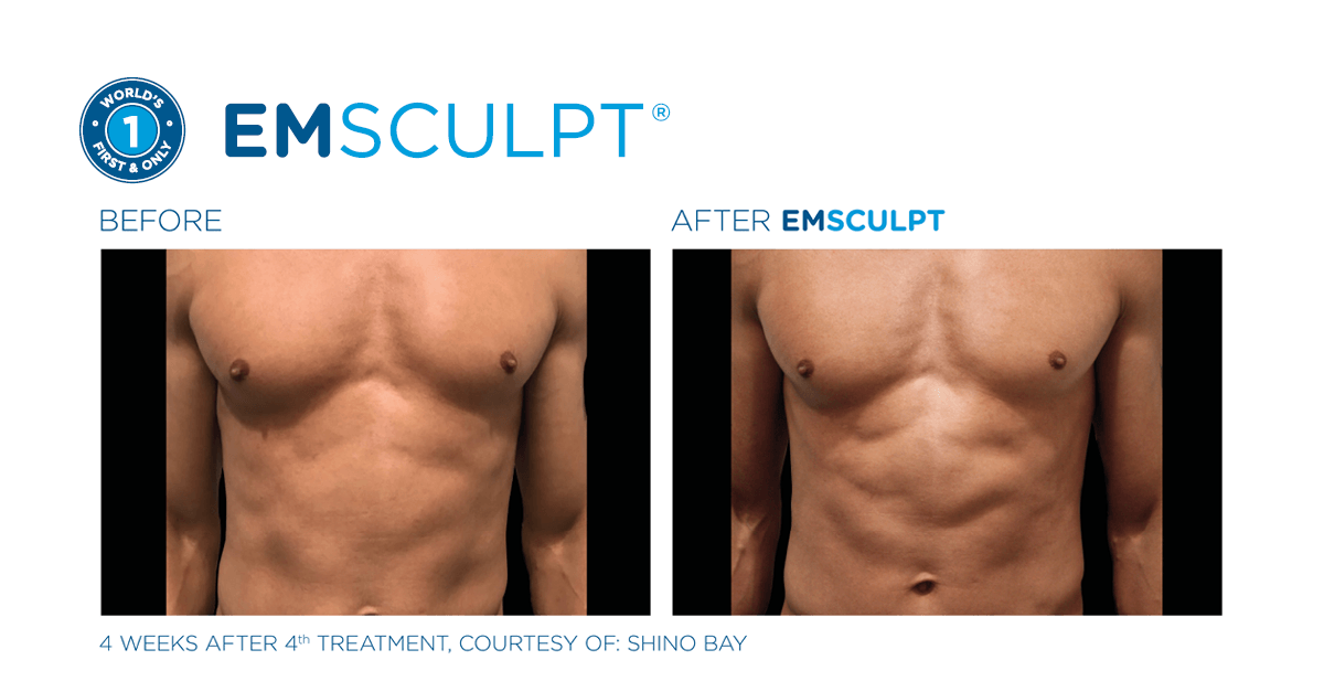 Guys, check out Dr. Mantor's for top-notch wrinkle and weight solutions designed just for men.
