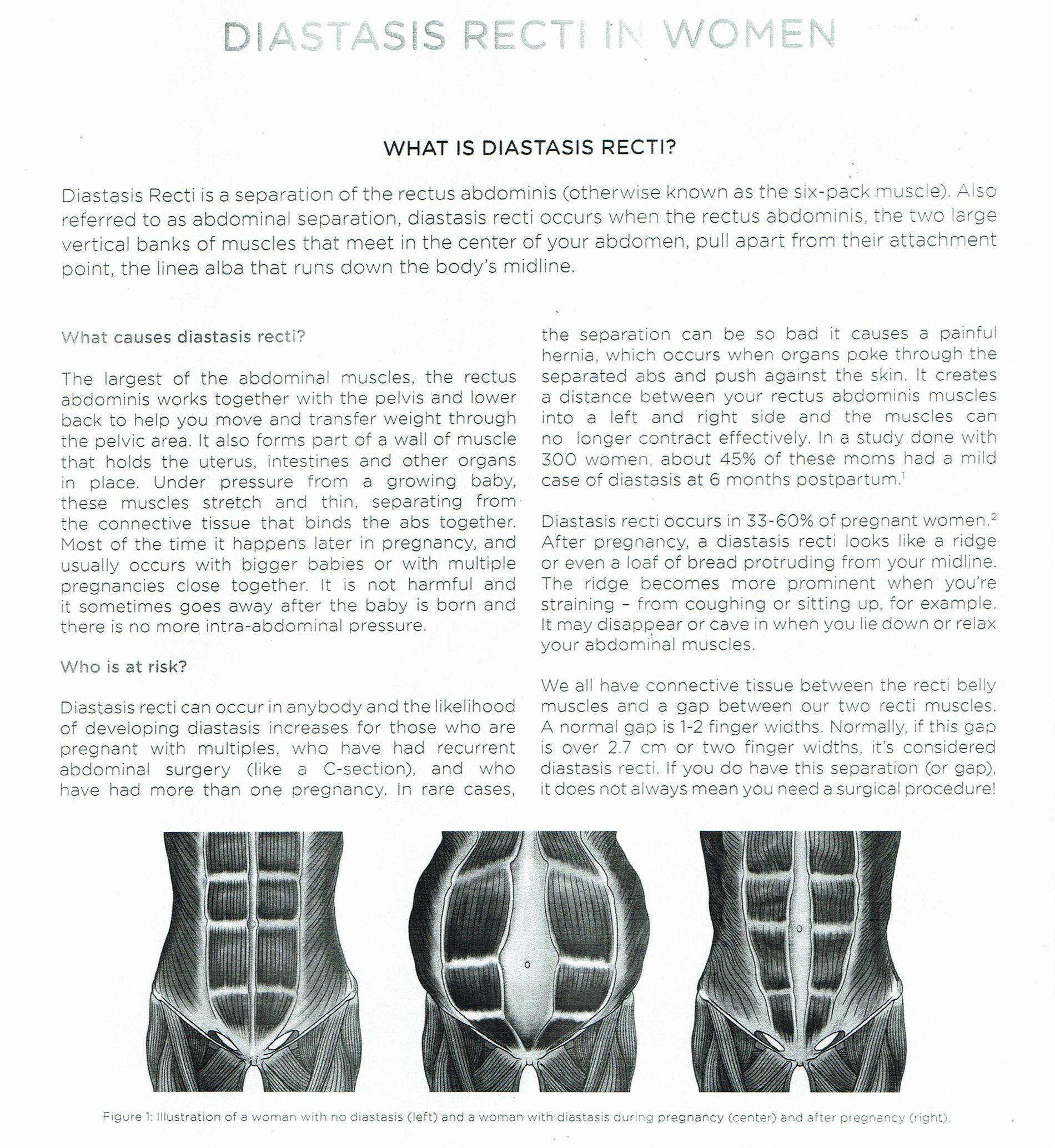 Non-invasive diastasis recti solution with FDA-cleared Emsculpt and Emsella. Enjoy free trials and consultations.