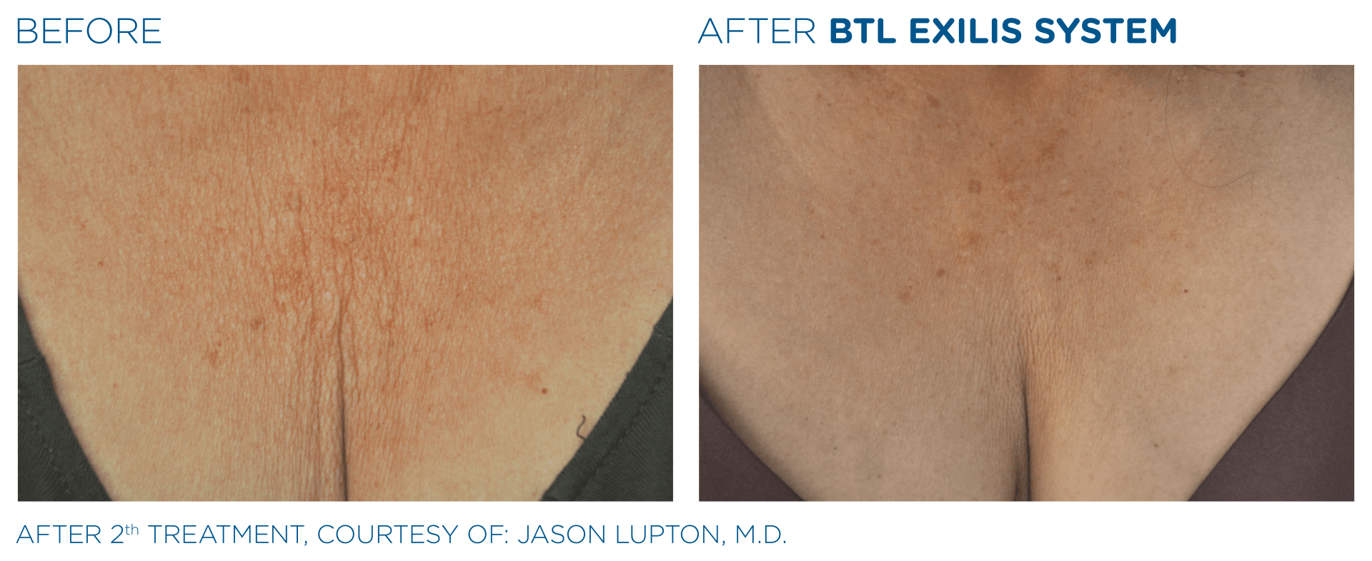 MD consultations are always free at Dr. Mantor's Wrinkle and Weight Solutions, LLC in Westerville, OH.