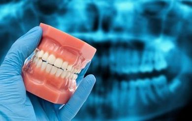 occlusione e postura