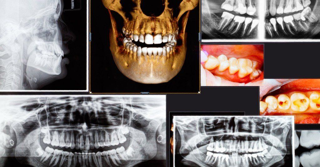 3D X-Ray Imaging in Rockville MD