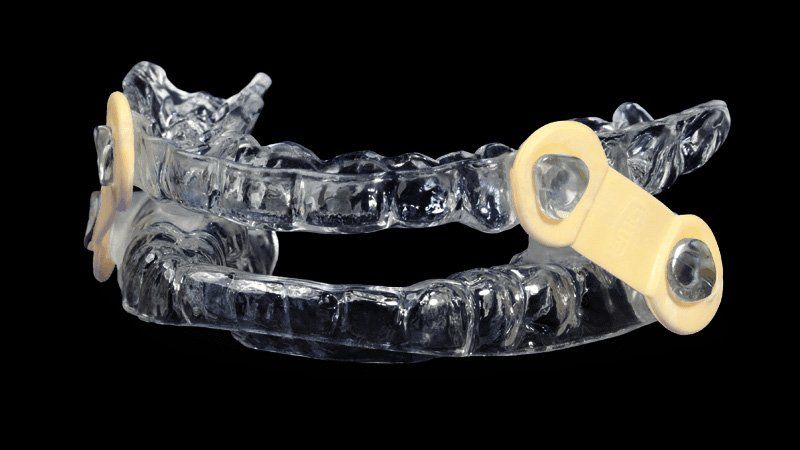 A clear plastic mouth guard with a yellow rubber band on a black background.