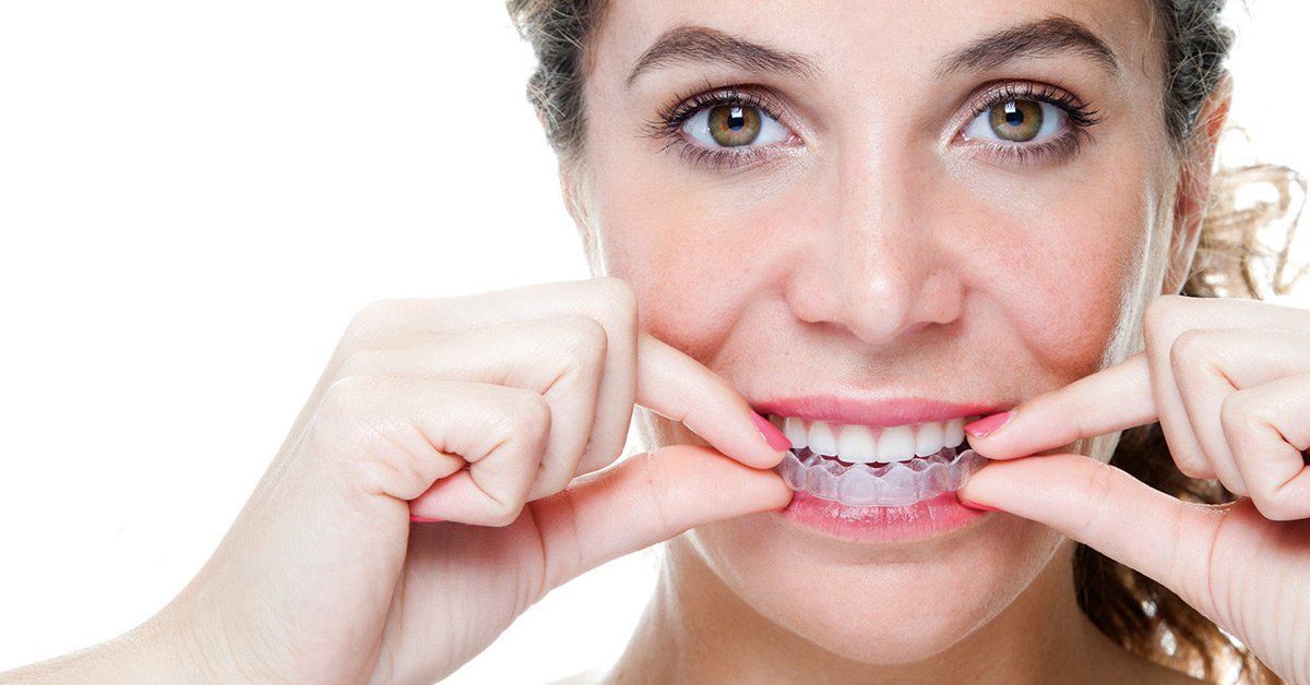 Invisalign FAQ