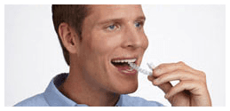 Man Inserting Invisalign Clear Aligners