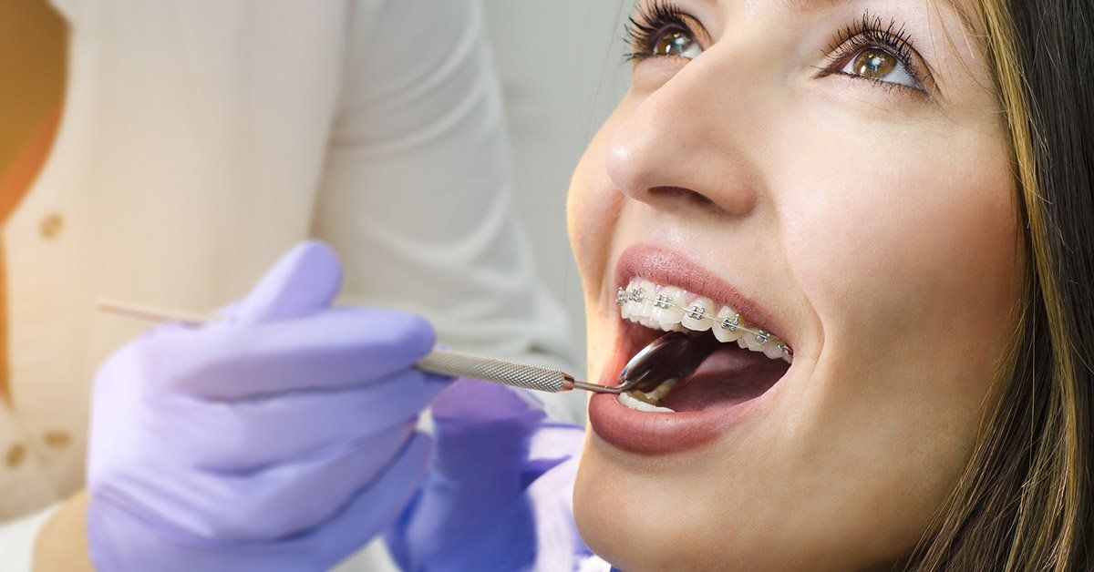 how do you know if you need braces