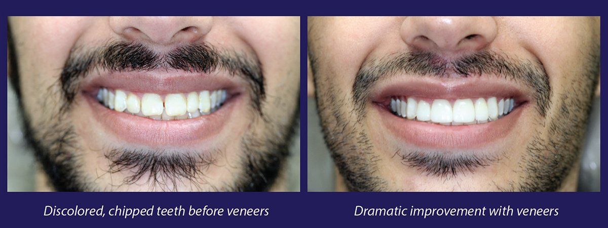 A man with a beard is smiling and showing his teeth.
