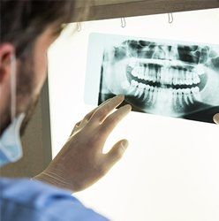 Doctor checking the xray — Dental Implants in Springfield, PA Doctor checking the xray — Dental Implants in Springfield, PA