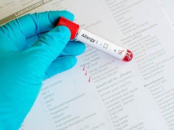 Conducting Test - allergy testing in Tampa, FL Conducting Test - allergy testing in Tampa, FL