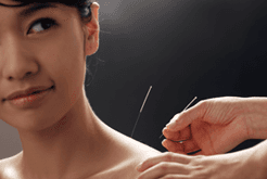 dermatological acupuncture therapy