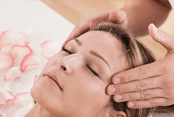 Chinese acupuncture
